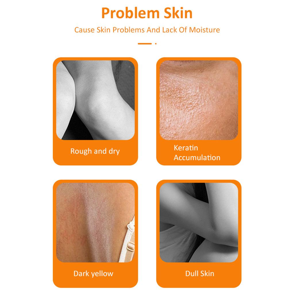 MOOYAM 100ml Orange Peeling Lotion Peeling Oil Body Lotion Gentle Exfoliating Gel Remove Dead Skin