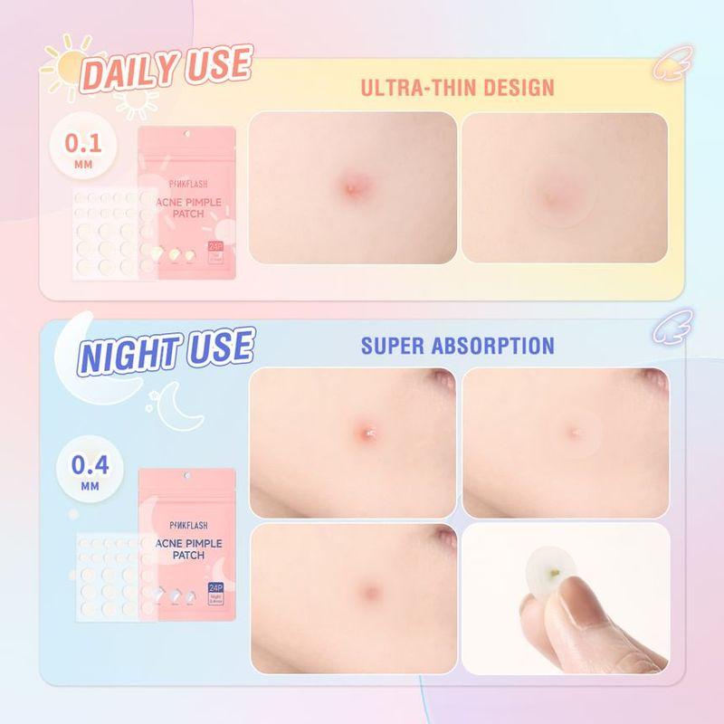 PINKFLASH - Acne Pimple Patch-Day & Night