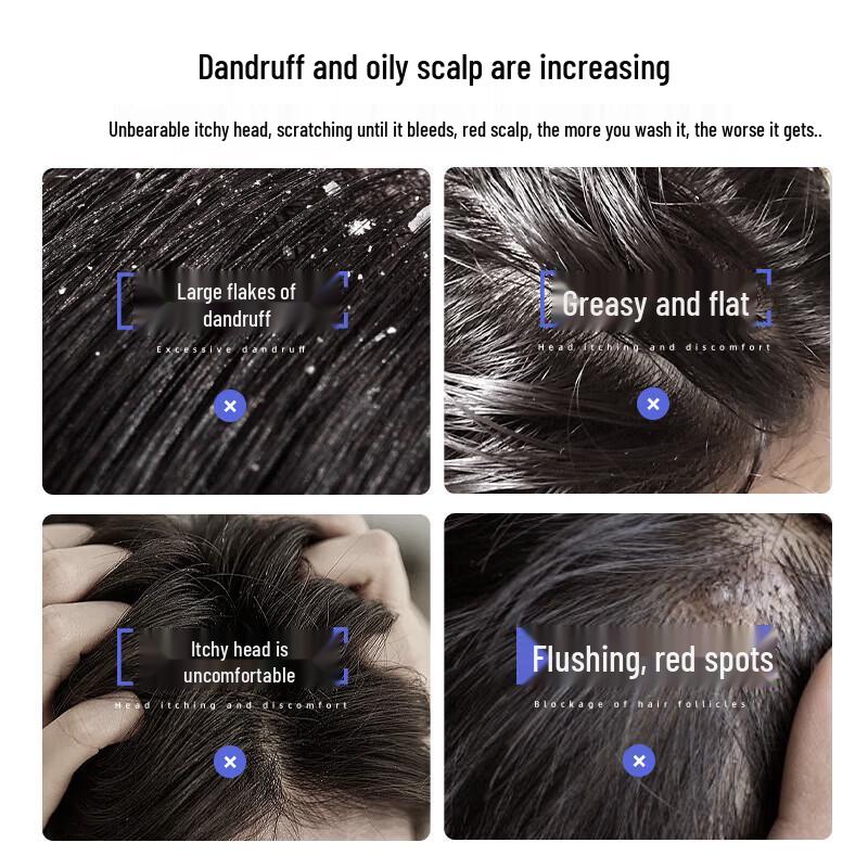 Cai Le Selenium Disulfide Anti-Dandruff Shampoo