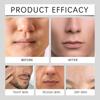 1pc Men's Hyaluronic Acid Moisturizing Cream, Relieves Dry And Rough Skin, Long-Lasting Moisturizing