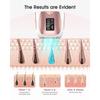 Épilation au laser avec refroidissement par glace - 999 900 flashs Appareil d'épilation IPL permanent et indolore pour tout le corps à domicile pour femmes et hommes