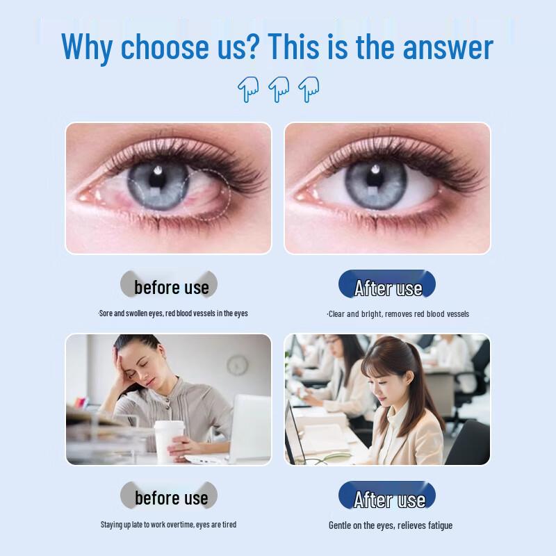 Kuihua Lutein Eye Spray