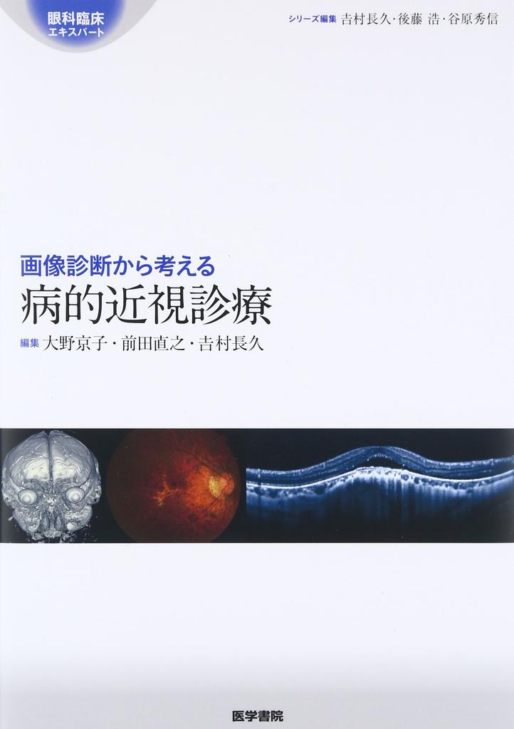 Pathological Myopia Treatment Based On Diagnostic Imaging (Ophthalmology Clinical Expert)