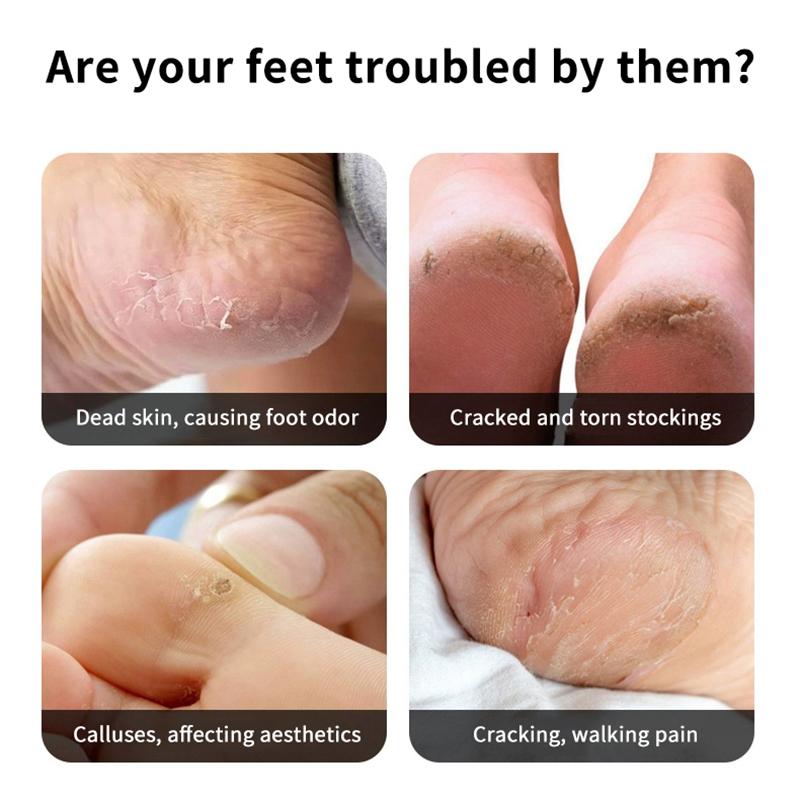 Pedicure Tools Heel Scratcher Files Artifact Exfoliating Calluses Brush Stainless Steel Foot Sharpening Double-Sided Pedicura