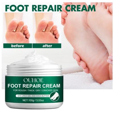 Anti Cracking Cream for DryMoisturizing Hand and Foot Cream for Cracked and Rough Skin, Repairing and Nourishing Hand Cream Removing Dead Skin