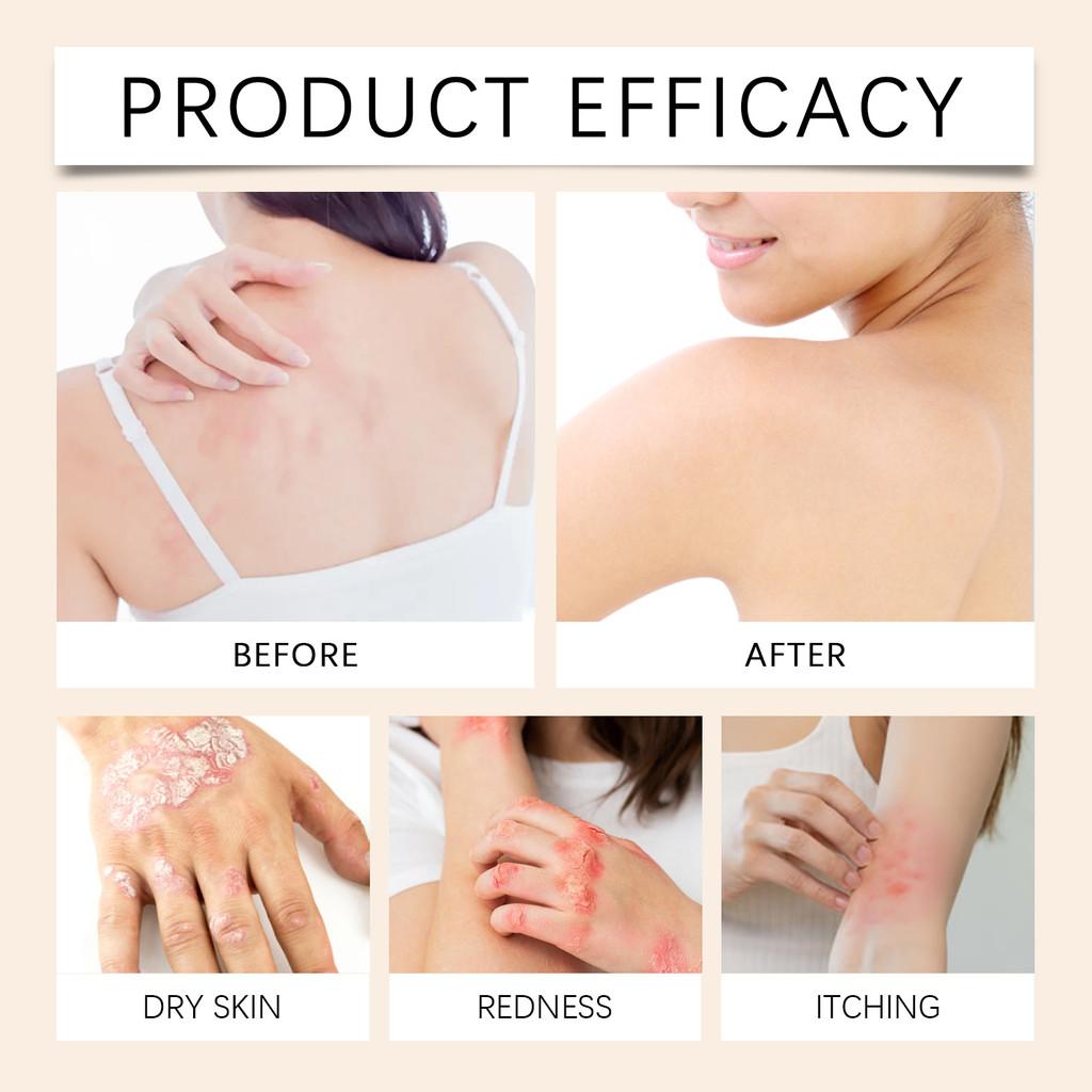 Ximonth Skin Care Cream Gentle Formula Daily Moisturizing Nourishing Cream For All Skin Types