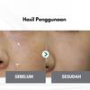 Rejuvenex Creme PDRN Rejuran Creme