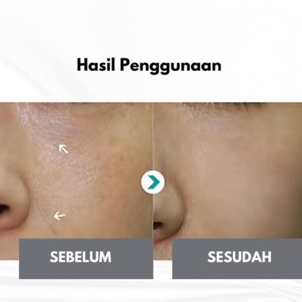 Rejuvenex Creme PDRN Rejuran Creme
