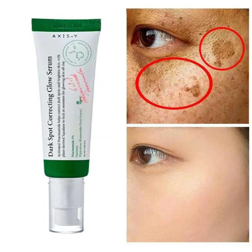 Non-Greasy Refreshed Essence Fade Color Spots Freckles Cream Moisturizing Essence  Face Skin