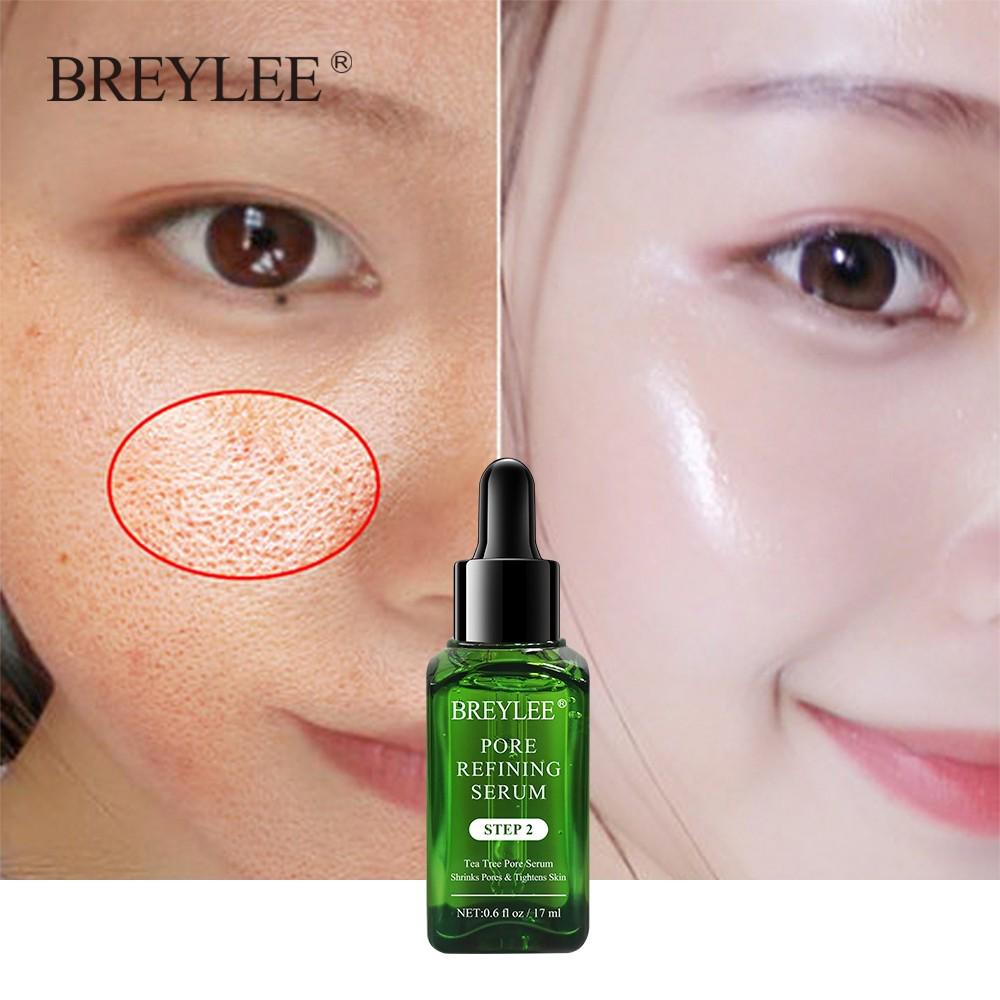 breylee blackhead removing kit