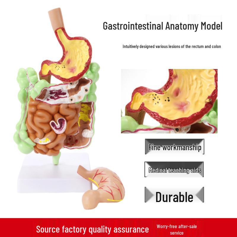Human Digestive System Model: Stomach, Large Intestine, Cecum, Rectum, Duodenum. 25*14 cm