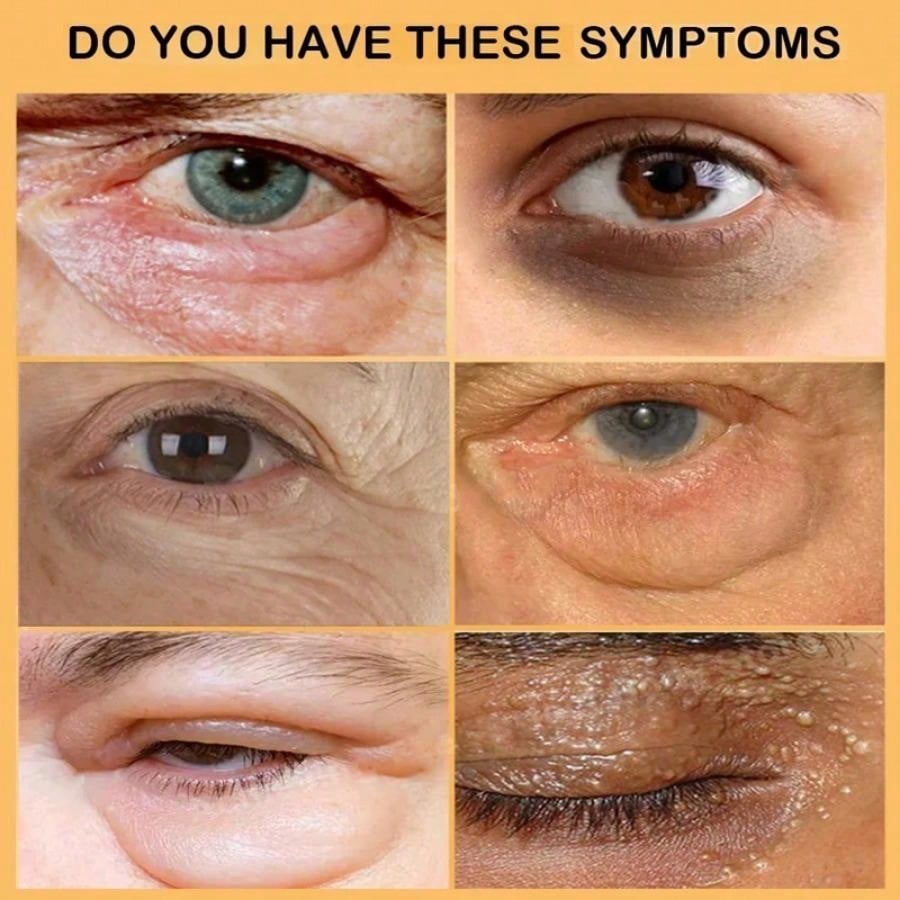 Snake Venom Eye Cream Anti-aging Eye Cream Reduces Red Light, Wrinkles, Dark Circles, Crow's Feet, Eye Care