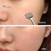 Dermatologist Recommended Skincare Tools 9Pcs Blackhead Remover Kit Stainless Steel Pimple Extractor Set with Storage Box Pore Cleaning Professional