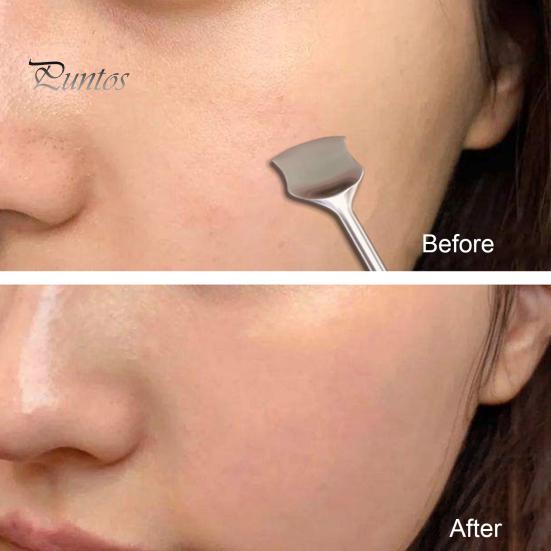 Dermatologist Recommended Skincare Tools 9Pcs Blackhead Remover Kit Stainless Steel Pimple Extractor Set with Storage Box Pore Cleaning Professional