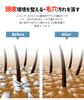 Scalp scalp massager men over Hair brush for for washing shampoo brush for men by a Soft scalp care brush, [for 40] bath, hair, [supervised