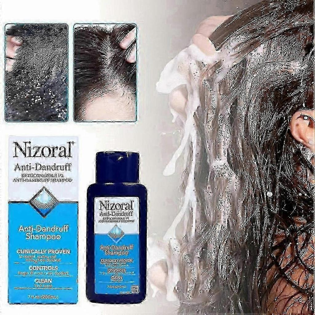 2025 Nizoral 7 Fl Oz Shampoo for Dandruff Control EXP