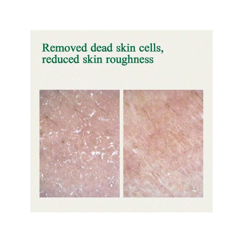 Pyunkang Yul Ultimate Calming Solution Cream For Sensitive Skin With Patented Ingredients, Moisturizer Intensely Calms (30ml)