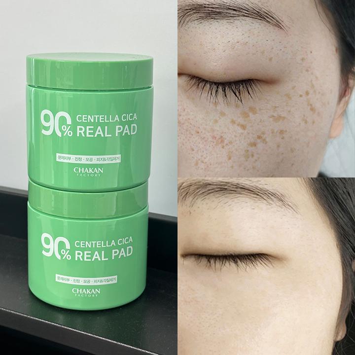 

Тонер-пэды с центеллой Cica 90%