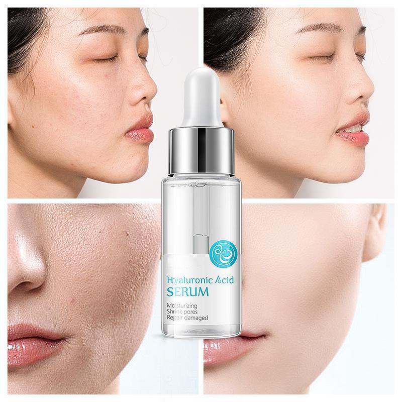 15ml Hyaluronic Acid Facial Serum Whitening, Anti-Wrinkle & Firming Skin Care Products