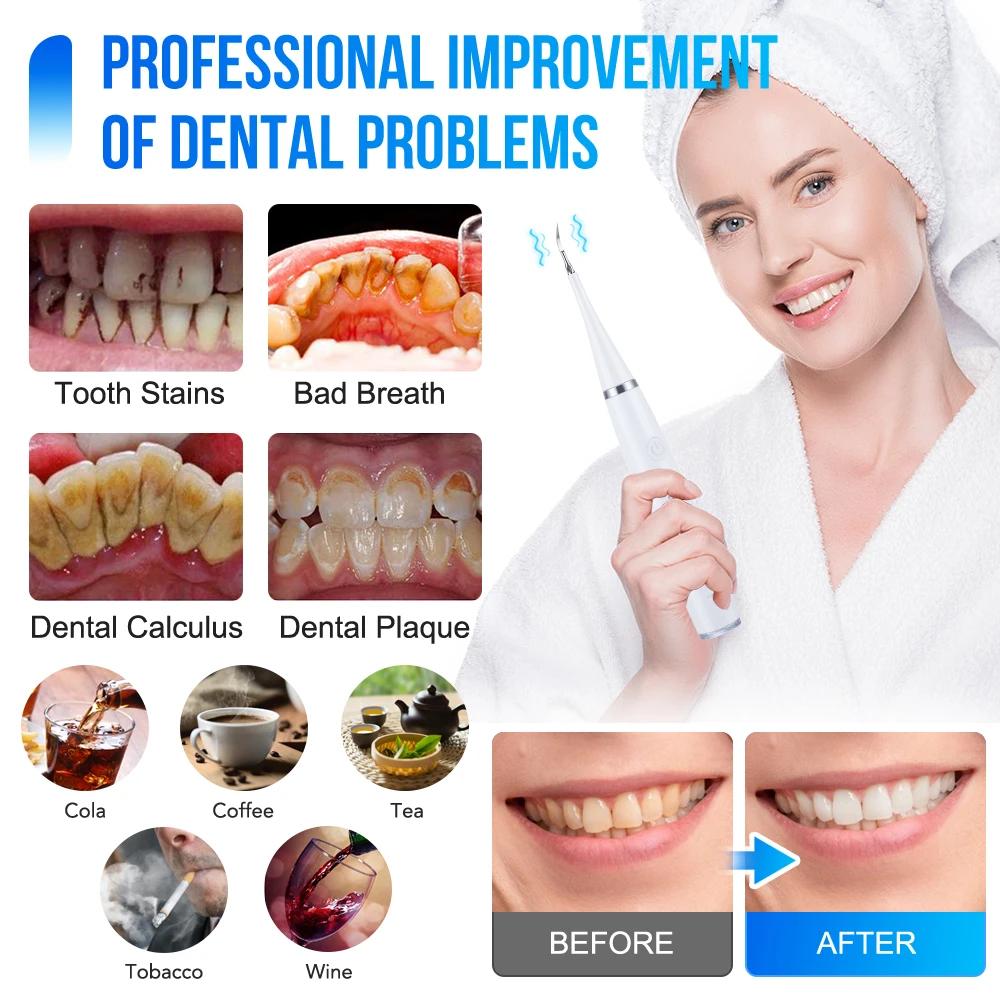 6 In 1 Ultrasonic Dental Cleaner Scaler Dental Tartar Remover Electric Toothbrush Sonic Teeth Plaque Cleaner Tooth Cleaner
