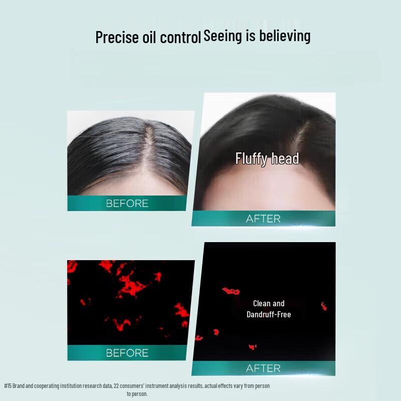 L'Oréal Scalp Oil Control Purifying Shampoo with Salicylic Acid