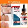 Eelhoe Nail Repair Liquid For Toenail And Fingernail Treatment With Strengthening Formula For Healthy Growth In 30ml Packaging
