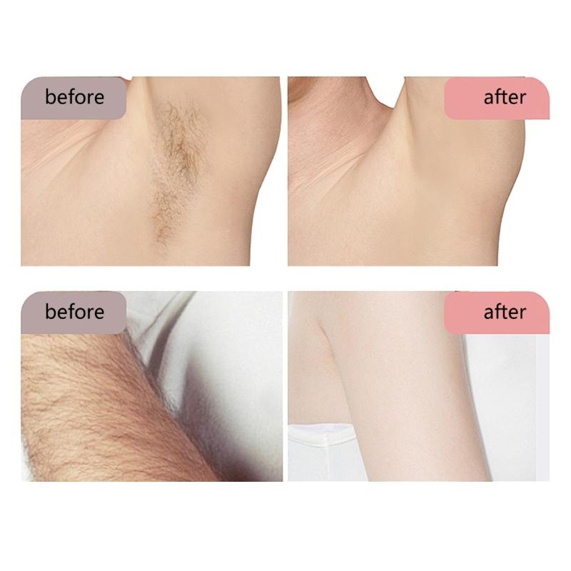 Rechargeable Cordless Hair Remover For Sensitive Skin Compact Travel Size ABS Material Unisex Body