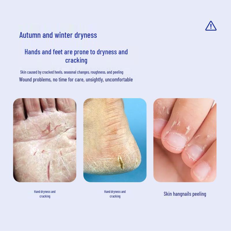 

Патч для рук и пяток Kobe против трещин, дышащий Foot Care