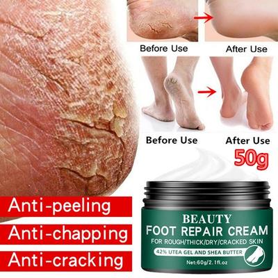 Neueste Hand- und Fußhautreparatur-Feuchtigkeitscreme gegen Rissbildung bei rauen, trockenen und rissigen Füßen. Fersenreparatur-Fußcreme