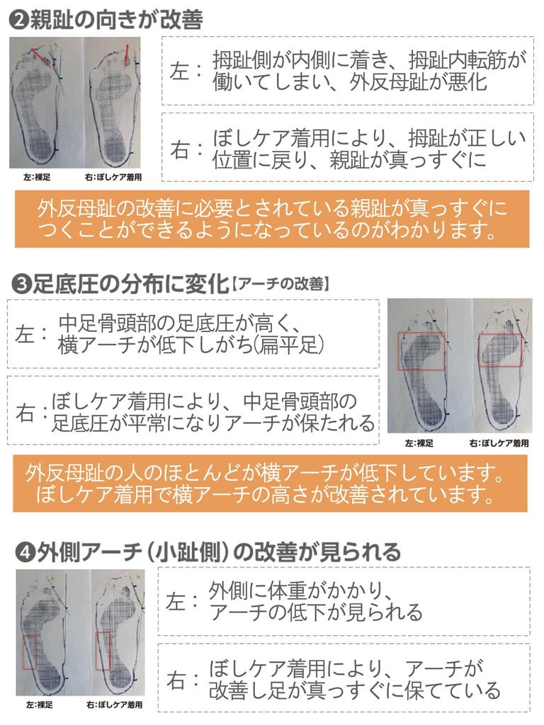 Kaituck Family Crew Made In Support Sizes Five-Toe Socks, Length, Japan, Women's Socks, 22.0-23.0, 23.5-24.5 (22.0-23.0, Pink)