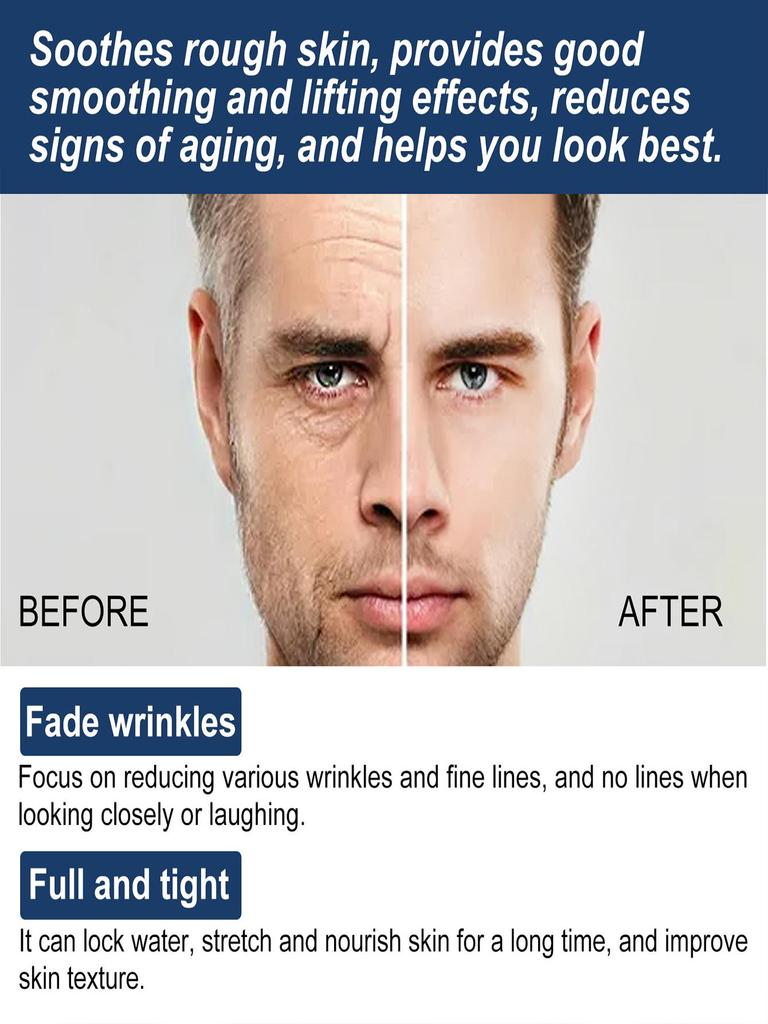 Face Essence Essential Oils Anti Wrinkle Anti-aging Lighten Spots Brightening Facial Skin Fade Remove Freckle Speckle Care