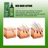 Ginger Hair Spray Promote Growth Anti Loss Improve Thin Dry Breakage Hair Nourish Root Scalp Damaged Treatment Hair Grow Spray