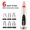 Hot Compress Electric Blackhead Remover With 6 Replacement Head Vacuum Suction Acne Tool  Women