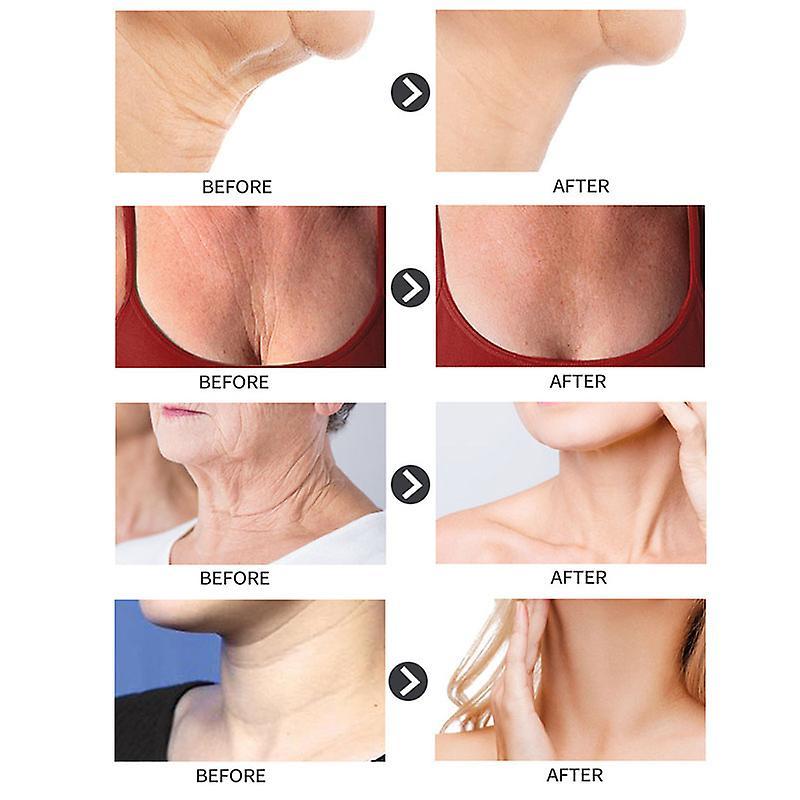 Anti-Wrinkle Neck Cream, Lifting Firming Repair Cream for Neck & Chest Lines, Anti-Aging Neck Treatment, Hydrating Moisturizer, 50ml