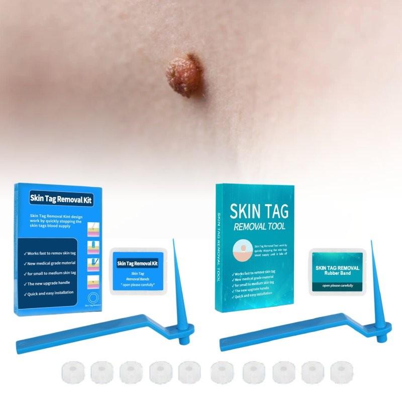 Effective Skin Tag Removal Tag Refill Band Set With 10 Pieces For Smooth Skin