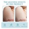 Ouhoe Body Butter Anti-wrinkle Cream Nourishing Hydrating Skin Treatment With Smooth Pore Refining Formula For Radiant Skin