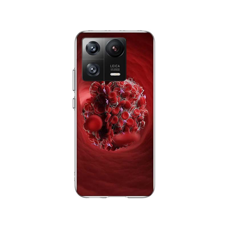 

Чехол для телефона Тромбоциты под микроскопом для Xiaomi Poco F7 Ultra X7 X6 M8 M7 M6 M4 M3 Pro X4 Mi 15 15T 14 14T 12T 12S 10T Pr Xiaomi Poco M3