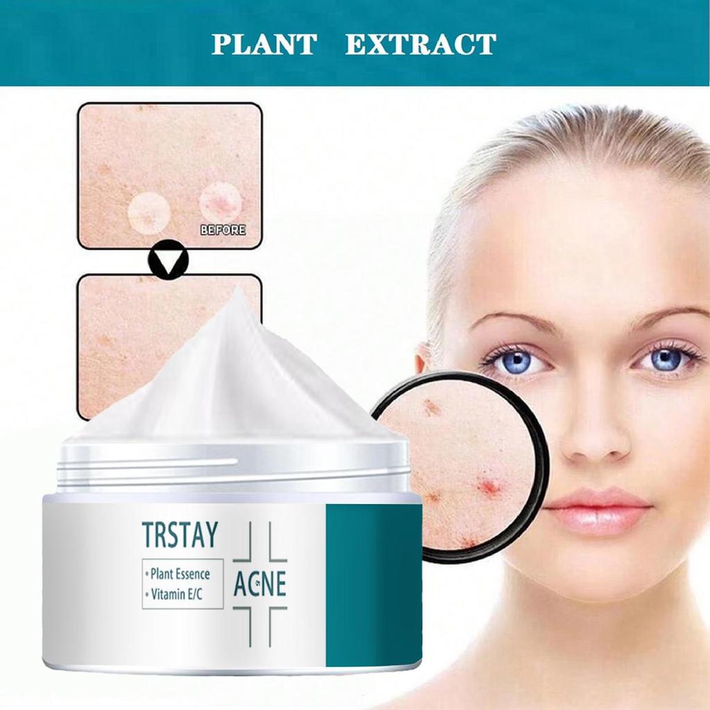 Die Creme ist sanft und nicht reizend, strafft die Haut, hellt den Teint auf, reduziert Flecken, spendet Feuchtigkeit und pflegt die Haut