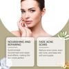 Ouhoe 7% Glycolic Acid Moisturizing Toner, Exfoliating Essence for Closed Comedones, Improves Skin Texture, Brightens & Smooths Skin