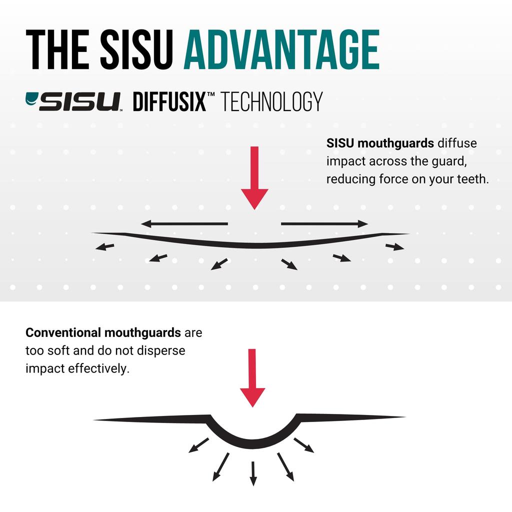 SISU 3D MouthGuard - 3D Mouthguard, Made In USA, 8 Colors, Size S, Custom Fit, for Small Faces, Sports, Kids, Soccer, Baseball, Skateboarding, Basketb