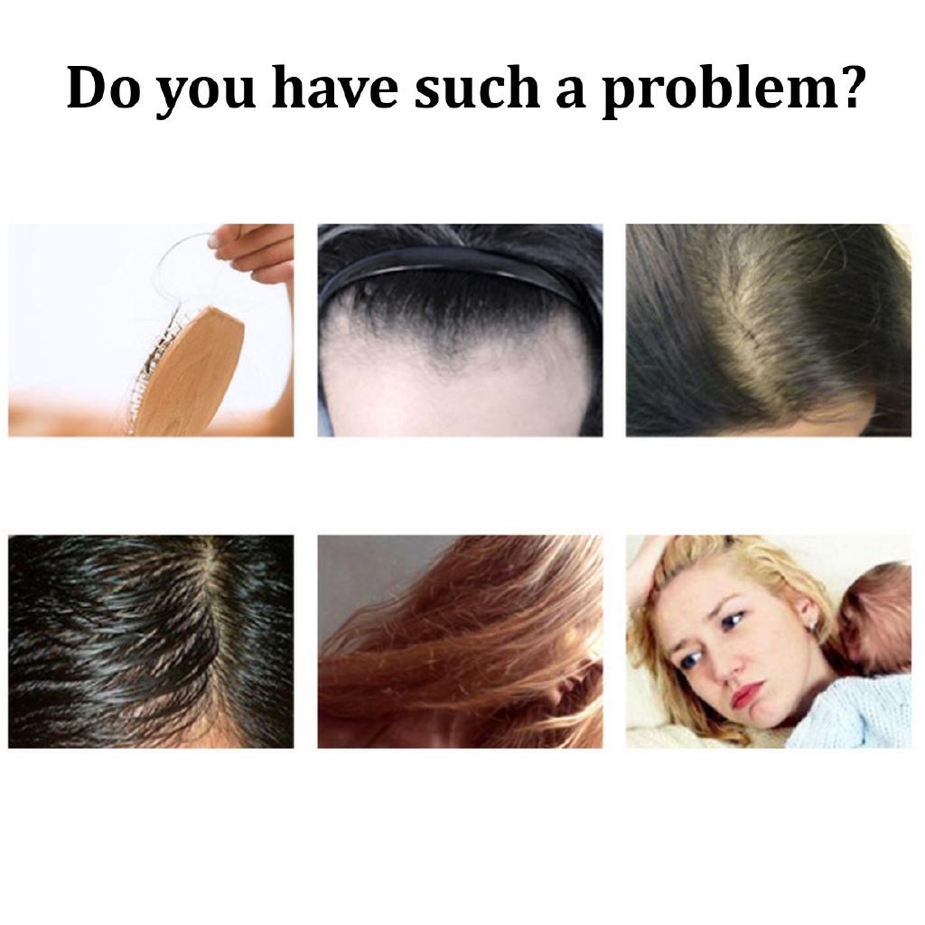 EMS Microcurrent Photon Light RF Hair Loss Renewable Therapy Vibration Massage Scalp Laser Hair Growth Rechargeable Care Device 3W