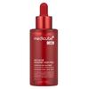 Red Acne Succinic Acid Peel