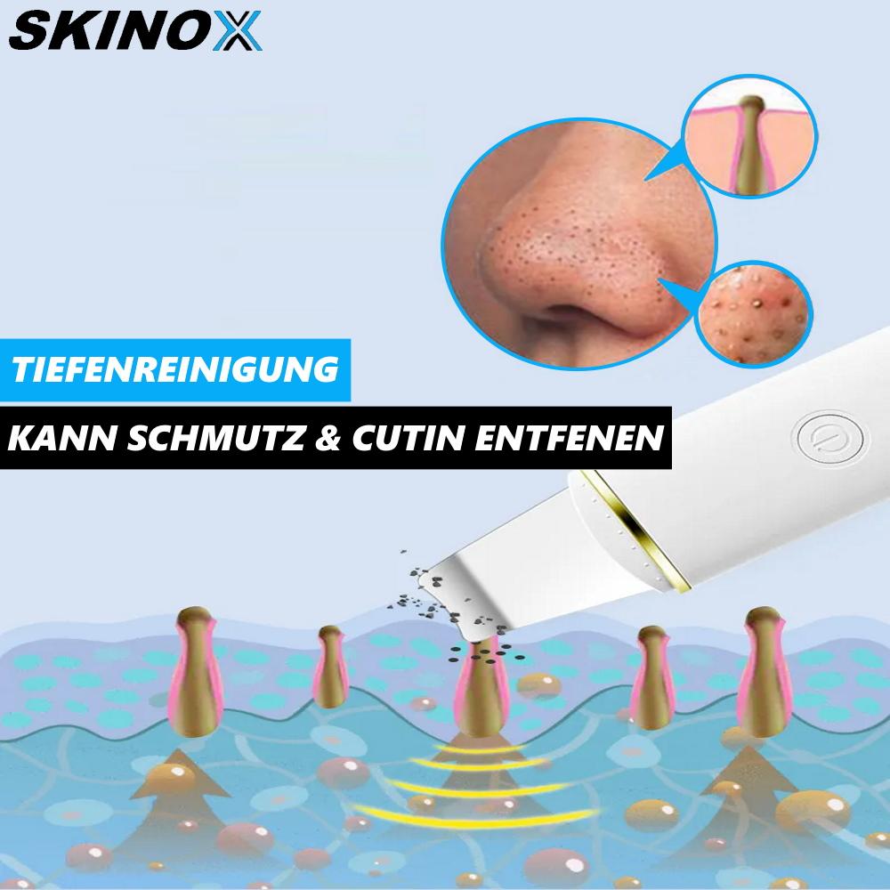 SKINOX Ultraschall Hautreiniger Gesichtsreinigungsbürste Gesichtsreiniger Bürste