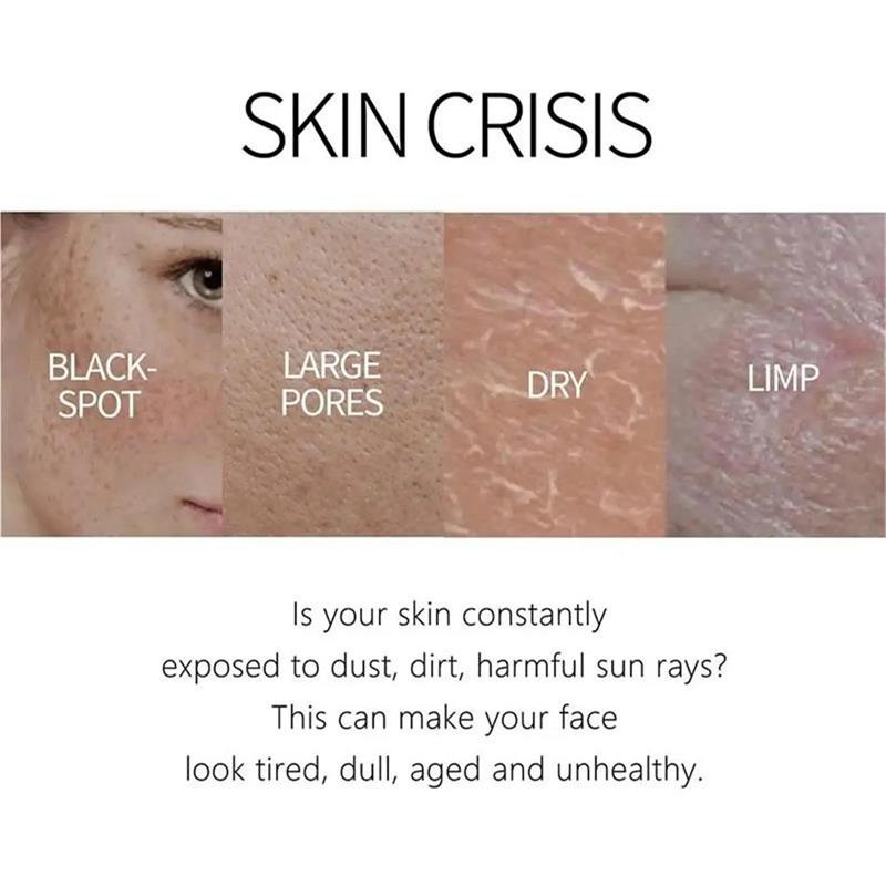 Freckle Whitening Cream Melasma Dark Spots Pigmentation Removal Product Fade Stain Melanin Fast Repair Brighten Korean Skin Car
