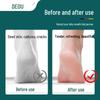 Foot Scrubber & Callus Remover: Pedicure Tool for Dead Skin, Calluses, Heels & Feet