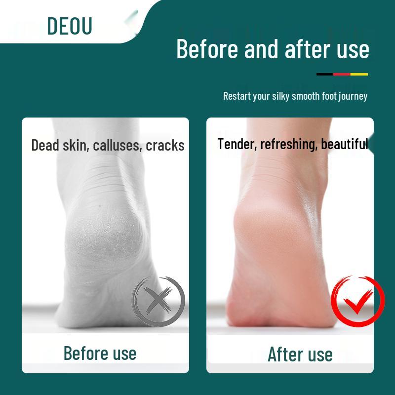 Foot Scrubber & Callus Remover: Pedicure Tool for Dead Skin, Calluses, Heels & Feet