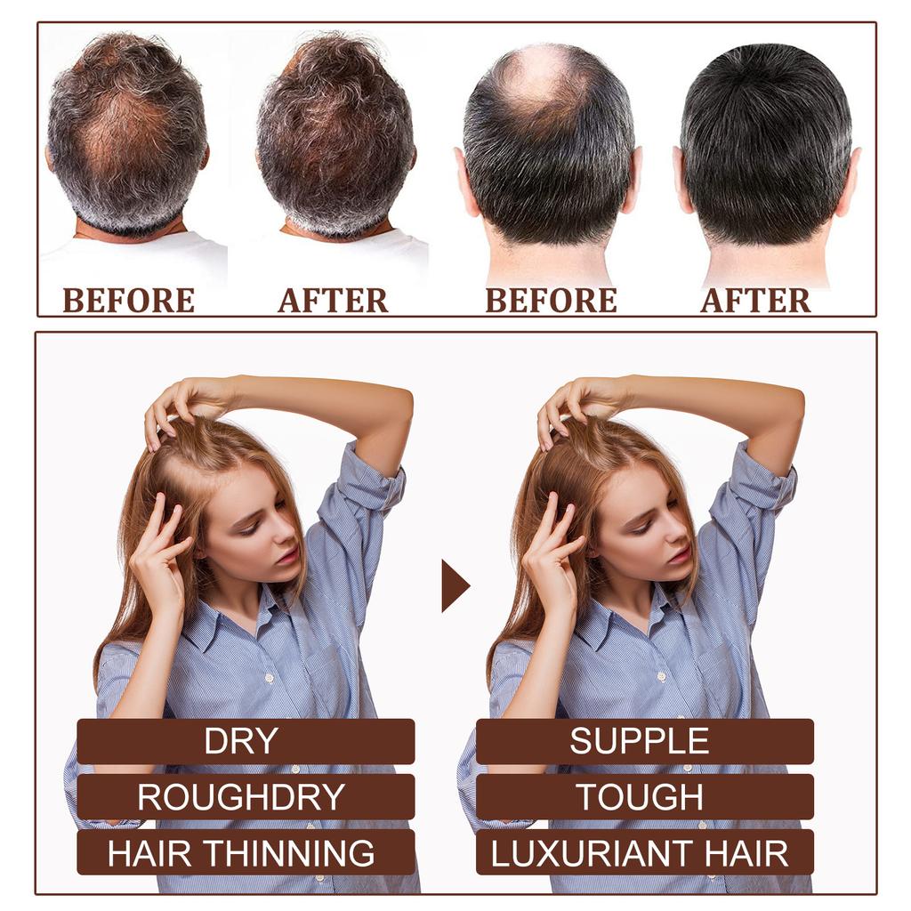 Huile essentielle de ricin pour cheveux denses Répare les cheveux abîmés Nourrit le cuir chevelu Cheveux épais Prévient la chute des cheveux Essence