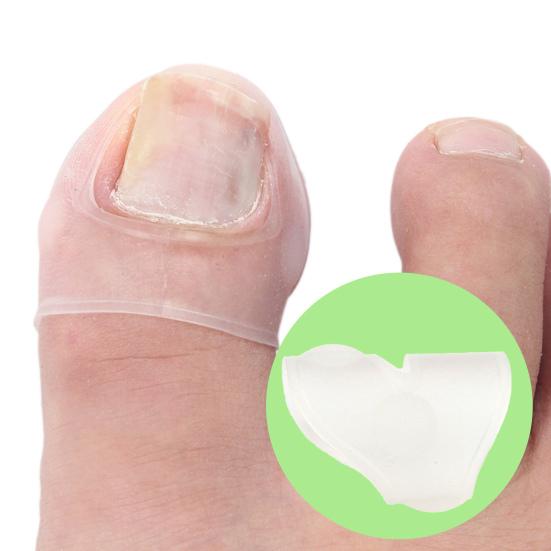 Yousheng Zehennagel Eingewachsenes Pflaster Ultradünnes Druckentlastungspflaster Unsichtbares orthognathisches Silikon-Nagelkorrekturpad für die Pediküre