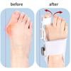 Adjustable Toe Corrector Unisex Bunion Foot Hallux Valgus Braces Rotatable Toe Separator Straightener for Left and Right Foot