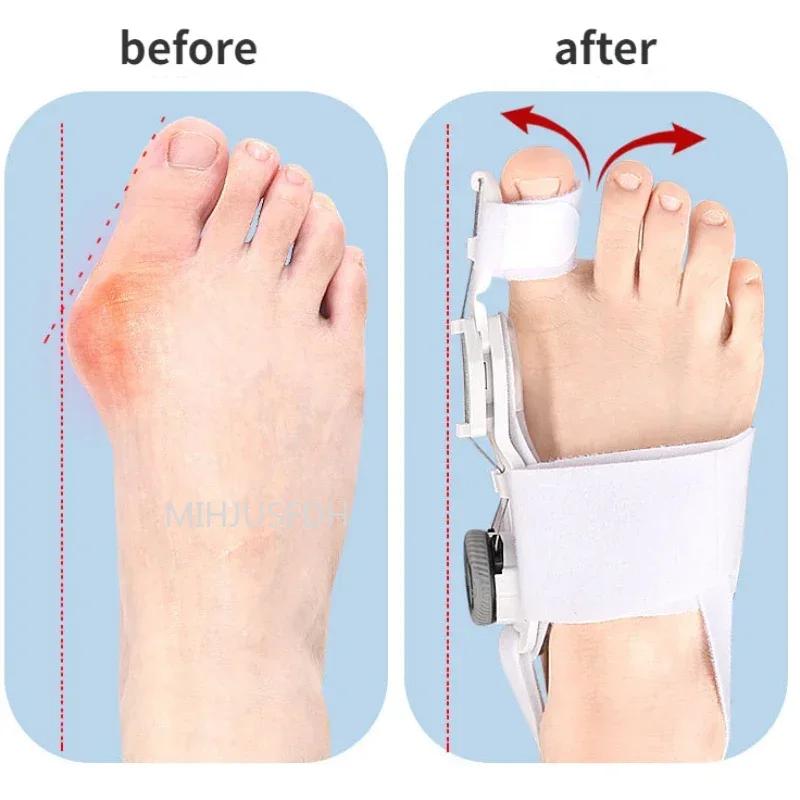 Adjustable Toe Corrector Unisex Bunion Foot Hallux Valgus Braces Rotatable Toe Separator Straightener for Left and Right Foot